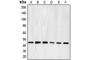 Western blot analysis of E2F4 expression in HeLa (A), K562 (B), Jurkat (C), Raji (D), A431 (E), mouse kidney (F) whole cell lysates. (E2F4 抗体  (Center))