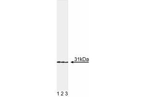 Western blot analysis of DsRed. (RFP 抗体)