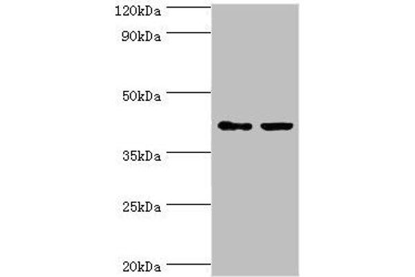 GTF2H2C anticorps  (AA 1-260)