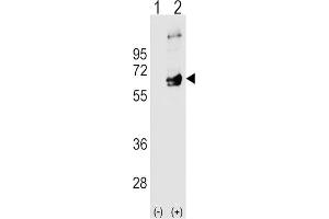Western Blotting (WB) image for anti-FYN Oncogene Related To SRC, FGR, YES (FYN) antibody (ABIN3003445) (FYN 抗体)