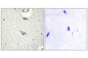 Immunohistochemistry (IHC) image for anti-Cell Adhesion Molecule 4 (CADM4) (C-Term) antibody (ABIN1850236) (Cell Adhesion Molecule 4 抗体  (C-Term))
