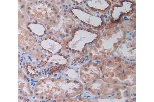 IHC-P analysis of kidney tissue, with DAB staining. (SLC12A3 抗体  (AA 3-146))