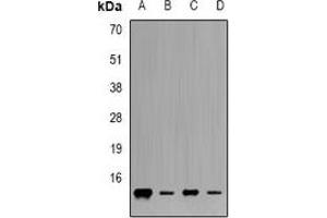 Western blot analysis of Frataxin expression in Jurkat (A), K562 (B), mouse heart (C), mouse liver (D) whole cell lysates. (Frataxin 抗体)