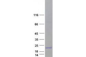 Western Blotting (WB) image for Midkine (Neurite Growth-Promoting Factor 2) (MDK) (Transcript Variant 1) protein (Myc-DYKDDDDK Tag) (ABIN2726001)