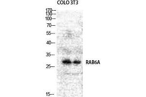 Western Blot (WB) analysis of COLO205 NIH-3T3 cells using Rab 6A Polyclonal Antibody. (RAB6A 抗体  (Internal Region))