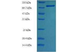TXNRD2 Protein (AA 37-524) (His-SUMO Tag)