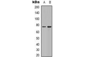 Western blot analysis of Synapsin 1 expression in Hela (A), mouse brain (B) whole cell lysates. (SYN1 抗体  (N-Term))