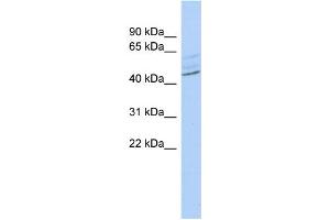 WB Suggested Anti-ZMYND12 Antibody Titration:  0. (ZMYND12 抗体  (Middle Region))