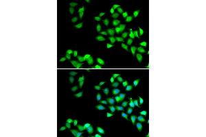Immunofluorescence analysis of HeLa cell using NNMT antibody. (NNMT 抗体)