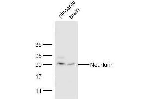 Mouse placenta and heart lysates probed with Rabbit Anti-Neurturin Polyclonal Antibody, Unconjugated  at 1:500 for 90 min at 37˚C. (Neurturin 抗体  (AA 151-197))