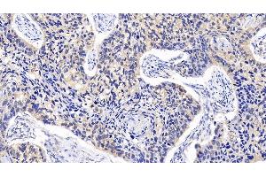 Immunohistochemistry (IHC) image for anti-Mitogen-Activated Protein Kinase 14 (MAPK14) (AA 19-279) antibody (ABIN7433252)
