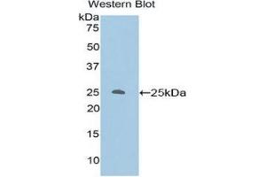 Western Blotting (WB) image for anti-Protein Kinase C, zeta (PRKCZ) (AA 404-591) antibody (ABIN3206748) (PKC zeta 抗体  (AA 404-591))