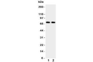 Western blot testing of Prolactin Receptor antibody and Lane 1:  HeLa;  2: MCF-7 cell lysate (Prolactin Receptor 抗体  (C-Term))