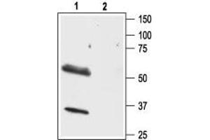 Western blot analysis of rat brain lysate: - 1. (HCRTR1 抗体  (AA 256-269))