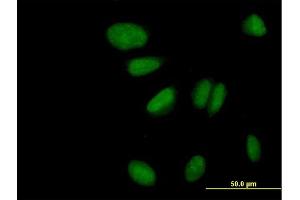 Immunofluorescence of purified MaxPab antibody to ZNF133 on HeLa cell. (ZNF133 抗体  (AA 1-653))