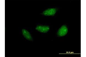 Immunofluorescence of purified MaxPab antibody to NOL6 on HeLa cell. (Nucleolar Protein 6 抗体  (AA 1-200))
