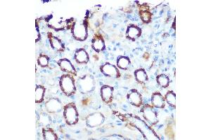 Immunohistochemistry of paraffin-embedded rat kidney using LONP1 Rabbit pAb (ABIN1680707, ABIN3018785, ABIN3018786 and ABIN6220576) at dilution of 1:100 (40x lens).