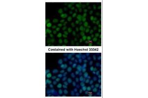 ICC/IF Image Immunofluorescence analysis of paraformaldehyde-fixed mouse ESC, using SOX2, antibody at 1:200 dilution. (SOX2 抗体)