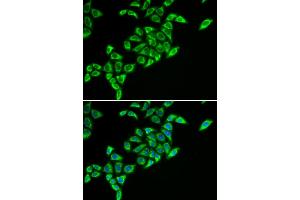 Immunofluorescence analysis of HeLa cells using DLAT antibody. (DLAT 抗体)
