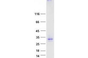 Western Blotting (WB) image for Glycoprotein M6A (GPM6A) (Transcript Variant 3) protein (Myc-DYKDDDDK Tag) (ABIN2722169)