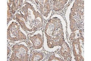 IHC analysis of COMT using anti-COMT antibody (ABIN7601948).