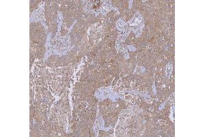 IHC analysis of WDR44 using anti-WDR44 antibody (ABIN7600394). (WDR44 抗体  (AA 188-913))