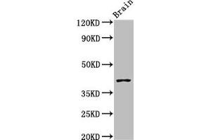 Western Blot Positive WB detected in: Mouse brain tissue All lanes: SEPT3 antibody at 3 μg/mL Secondary Goat polyclonal to rabbit IgG at 1/50000 dilution Predicted band size: 41, 10 kDa Observed band size: 41 kDa (Septin 3 抗体  (AA 238-358))