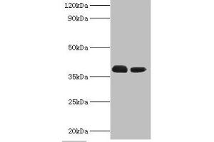 Western blot All lanes: Three-prime repair exonuclease 1 antibody at 3 μg/mL Lane 1: Hela whole cell lysate Lane 2: HepG2 whole cell lysate Secondary Goat polyclonal to rabbit IgG at 1/10000 dilution Predicted band size: 39, 33, 34 kDa Observed band size: 39 kDa (TREX1 抗体  (AA 1-270))
