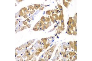 Immunohistochemistry of paraffin-embedded mouse heart using PPP1R12A Antibody (ABIN5974045) at dilution of 1/100 (40x lens). (PPP1R12A 抗体)