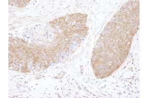 Immunohistochemistry (IHC) image for anti-Chaperonin Containing TCP1, Subunit 5 (Epsilon) (CCT5) (AA 150-200) antibody (ABIN7453617)