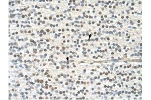 GAPVD1 antibody was used for immunohistochemistry at a concentration of 4-8 ug/ml to stain Neural cells (arrows) in Human Brain. (GAPVD1 抗体  (N-Term))