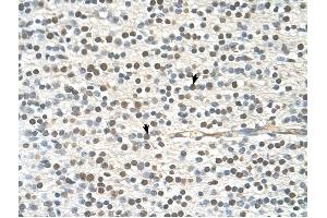 GAPVD1 antibody was used for immunohistochemistry at a concentration of 4-8 ug/ml to stain Neural cells (arrows) in Human Brain.