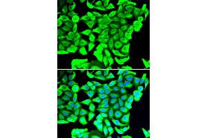 Immunofluorescence analysis of MCF-7 cells using DCD antibody (ABIN5974382). (Dermcidin 抗体)