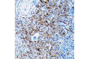 Immunohistochemistry (IHC) image for anti-Solute Carrier Family 8 (Sodium/calcium Exchanger), Member 1 (SLC8A1) (AA 250-520) antibody (ABIN6148050)