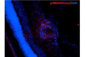 Immunohistochemistry (IHC) image for anti-Mitogen-Activated Protein Kinase 14 (MAPK14) antibody (Biotin) (ABIN2486141)