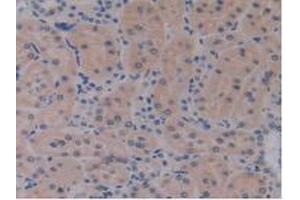 Detection of IL17RE in Rat Kidney Tissue using Polyclonal Antibody to Interleukin 17 Receptor E (IL17RE) (IL17RE 抗体  (AA 457-626))