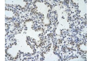 Immunohistochemistry (IHC) image for anti-Zinc Finger (CCCH Type), RNA-Binding Motif and serine/arginine Rich 2 (ZRSR2) (C-Term) antibody (ABIN2778926)
