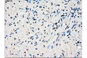 Immunohistochemical staining of paraffin-embedded endometrium tissue using anti-PORmouse monoclonal antibody. (POR 抗体)