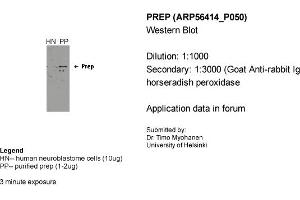 Western Blotting (WB) image for anti-Prolyl Endopeptidase (PREP) (Middle Region) antibody (ABIN503960) (PREP 抗体  (Middle Region))
