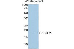 Western Blotting (WB) image for anti-TAF13 RNA Polymerase II, TATA Box Binding Protein (TBP)-Associated Factor, 18kDa (TAF13) (AA 1-124) antibody (ABIN1860676)