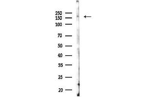 anti-CAP-GLY Domain Containing Linker Protein 1 (CLIP1) (C-Term) antibody