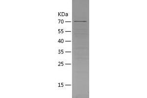 Western Blotting (WB) image for Cereblon (CRBN) (AA 1-442) protein (His-IF2DI Tag) (ABIN7122245) (CRBN Protein (AA 1-442) (His-IF2DI Tag))