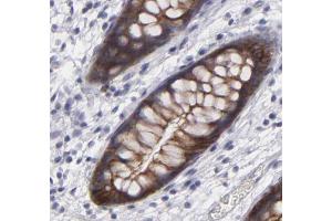 Catenin-γ Antibody for IHC in human colon tissue.