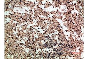 Immunohistochemical analysis of paraffin-embedded human-spleen, antibody was diluted at 1:200 (PF4 抗体  (AA 51-100))