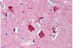 Human Brain, Cortex (formalin-fixed, paraffin-embedded) stained with NGFR antibody ABIN214454 at 5 ug/ml followed by biotinylated goat anti-rabbit IgG secondary antibody ABIN481713, alkaline phosphatase-streptavidin and chromogen. (NGFR 抗体)