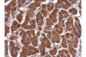 IHC-P Image Immunohistochemical analysis of paraffin-embedded human hepatoma, using ANGPTL3, antibody at 1:500 dilution. (ANGPTL3 抗体)