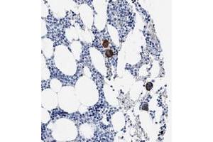 Immunohistochemical staining of human bone marrow with TREML1 polyclonal antibody  shows strong cytoplasmic positivity in megakaryocytes of bone marrow poietic cells. (TREML1 抗体)