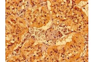 Immunohistochemistry of paraffin-embedded human adrenal gland tissue using ABIN7158957 at dilution of 1:100 (MCAT 抗体  (AA 22-117))