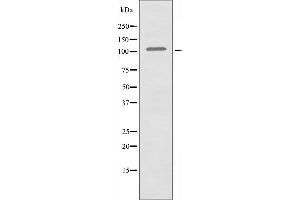Western blot analysis of extracts from HeLa cells, using HXK1 antibody. (Hexokinase 1 抗体  (N-Term))