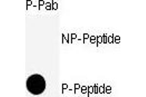 Dot blot analysis of anti-CDK11-S39 Phospho-specific Pab (ABIN389538 and ABIN2839585) on nitrocellulose membrane.